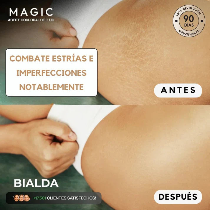 Magic Body Oil -  Para estrías, flacidez y piel seca
