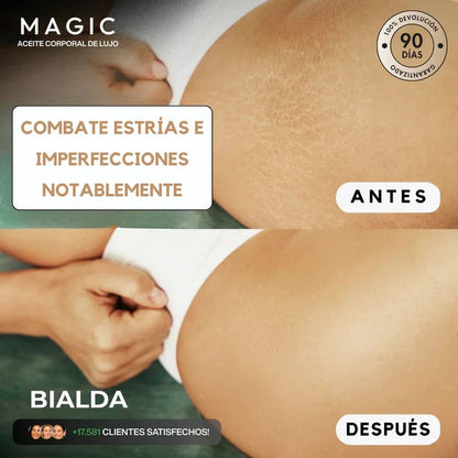 Magic Body Oil -  Para estrías, flacidez y piel seca
